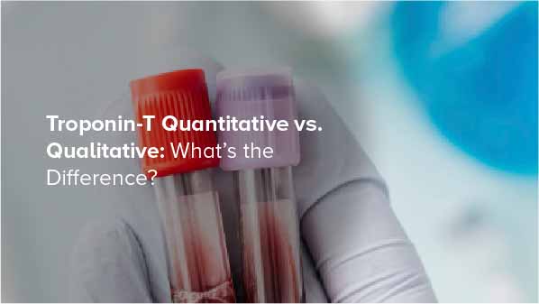 Troponin-T Tests: Quantitative vs Qualitative Explained